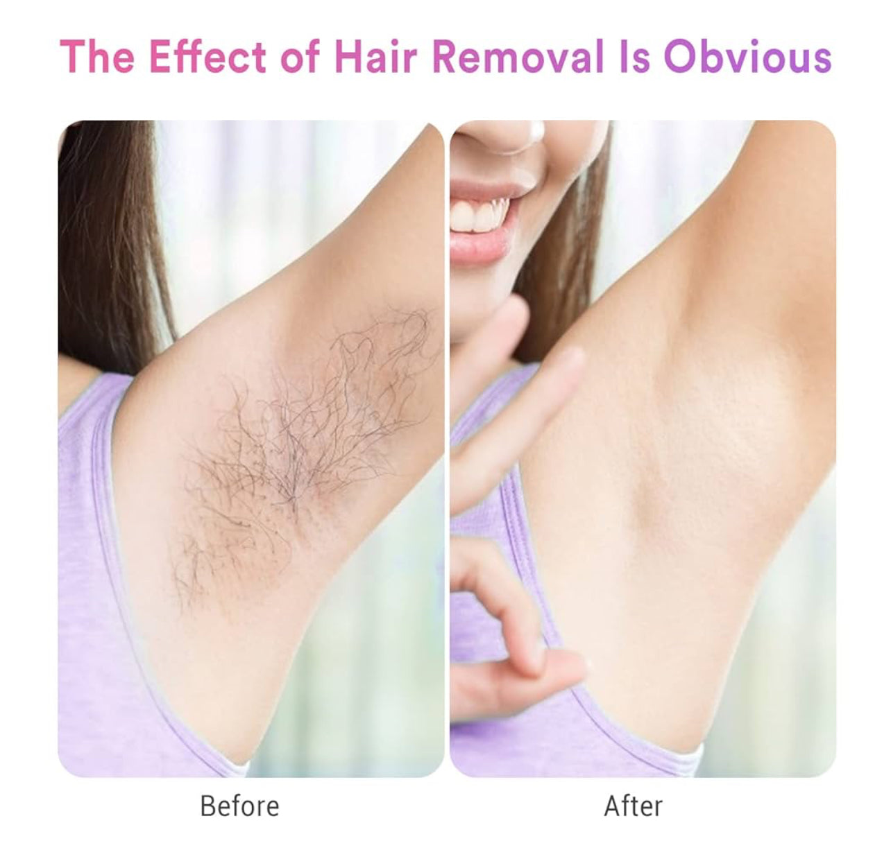 IPL Hair Removal - Ice-Cooling, Painless Laser for Women & Men, FDA Cleared, Permanent Hair Removal Device for Face & Body, 999999 Flashes with 5 Modes